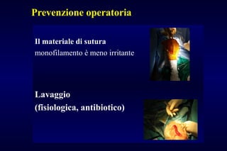 Prevenzione operatoria
Il materiale di sutura
monofilamento è meno irritante
Lavaggio
(fisiologica, antibiotico)
 