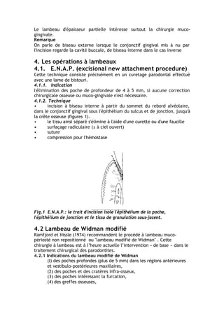 Le lambeau d'épaisseur partielle intéresse surtout la chirurgie muco-
gingivale.
Remarque
On parle de biseau externe lorsque le conjonctif gingival mis à nu par
l'incision regarde la cavité buccale, de biseau interne dans le cas inverse
4. Les opérations à lambeaux
4.1. E.N.A.P. (excisional new attachment procedure)
Cette technique consiste précisément en un curetage parodontal effectué
avec une lame de bistouri.
4.1.1. Indication
l'élimination des poche de profondeur de 4 à 5 mm, si aucune correction
chirurgicale osseuse ou muco-gingivale n'est nécessaire.
4.1.2. Technique
• incision à biseau interne à partir du sommet du rebord alvéolaire,
dans le conjonctif gingival sous l'épithélium du sulcus et de jonction, jusqu'à
la crête osseuse (figures 1).
• le tissu ainsi séparé s'élimine à l'aide d'une curette ou d'une faucille
• surfaçage radiculaire (± à ciel ouvert)
• suture
• compression pour l'hémostase
Fig.1 E.N.A.P.: le trait d'incision isole l'épithélium de la poche,
l'épithélium de jonction et le tissu de granulation sous-jacent.
4.2 Lambeau de Widman modifié
Ramfjord et Nissle (1974) recommandent le procédé à lambeau muco-
périosté non repositionné ou "lambeau modifié de Widman" . Cette
chirurgie à lambeau est à l’heure actuelle l’intervention « de base » dans le
traitement chirurgical des parodontites.
4.2.1 Indications du lambeau modifié de Widman
(I) des poches profondes (plus de 5 mm) dans les régions antérieures
et vestibulo-postérieures maxillaires,
(2) des poches et des cratères infra-osseux,
(3) des poches intéressant la furcation,
(4) des greffes osseuses,
 