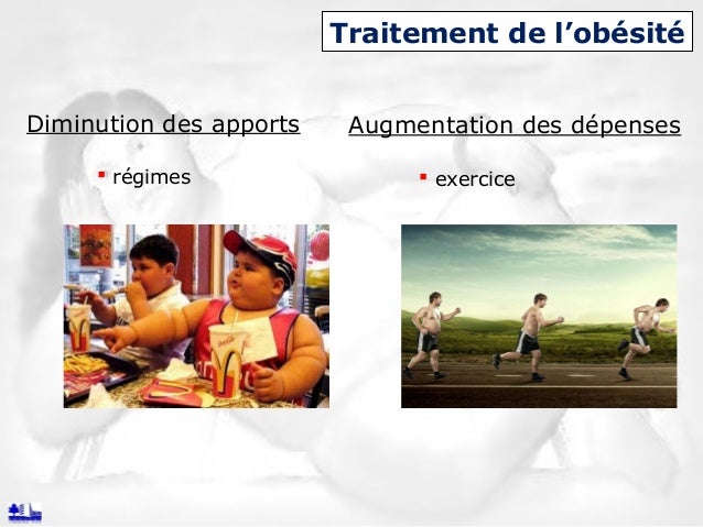 Chirurgie de l'obésité Chirurgie de l'obésité