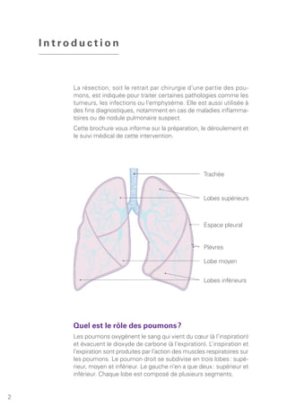 La résection, soit le retrait par chirurgie d’une partie des pou-
mons, est indiquée pour traiter certaines pathologies comme les
tumeurs, les infections ou l’emphysème. Elle est aussi utilisée à
des fins diagnostiques, notamment en cas de maladies inflamma-
toires ou de nodule pulmonaire suspect.
Cette brochure vous informe sur la préparation, le déroulement et
le suivi médical de cette intervention.
I n t r o d u c t i o n
2
Trachée
Lobes supérieurs
Espace pleural
Plèvres
Lobe moyen
Lobes inférieurs
Quel est le rôle des poumons ?
Les poumons oxygènent le sang qui vient du cœur (à l’inspiration)
et évacuent le dioxyde de carbone (à l’expiration). L’inspiration et
l’expiration sont produites par l’action des muscles respiratoires sur
les poumons. Le poumon droit se subdivise en trois lobes : supé-
rieur, moyen et inférieur. Le gauche n’en a que deux : supérieur et
inférieur. Chaque lobe est composé de plusieurs segments.
 