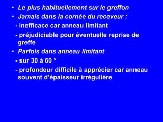 Le plus habituellement sur le greffonJamais dans la cornée du receveur :  - inefficace car anneau limitant  - préjudiciable pour éventuelle reprise de greffeParfois dans anneau limitant  - sur 30 à 60 °  - profondeur difficile à apprécier car anneau souvent d’épaisseur irrégulière