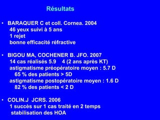                           RésultatsBARAQUER C et coll. Cornea. 200446 yeux suivi à 5 ans1 rejetbonne efficacité réfractiveBIGOU MA, COCHENER B. JFO. 200714 cas réalisés 5.9 ± 4 (2 ans après KT)astigmatismepréopératoiremoyen : 5.7 D	65 % des patients > 5Dastigmatismepostopératoiremoyen : 1.6 D	82 % des patients < 2 DCOLIN.J  JCRS. 20061 succès sur 1 cas traité en 2 temps stabilisation des HOA