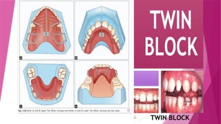 CHITRA TWIN BLOCK orthodontic myofunctional appliance .pptx