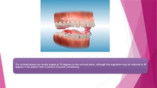 CHITRA TWIN BLOCK orthodontic myofunctional appliance .pptx