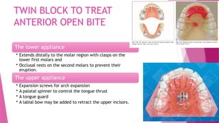 CHITRA TWIN BLOCK orthodontic myofunctional appliance .pptx