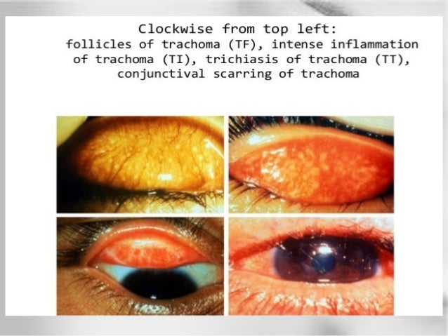 12 Proven Health Benefits of Avocado