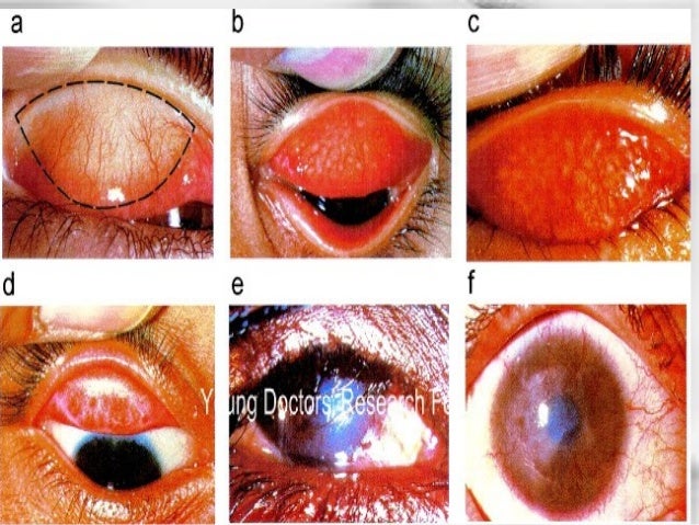 Generico del cialis en venezuela