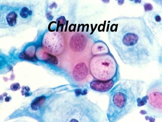 Chlamydia 
 