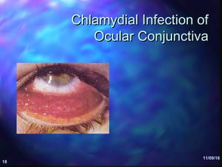 Chlamydia | PPT
