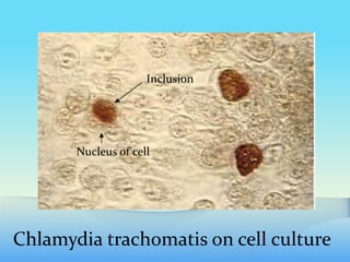 Chlamydia trachomatis on cell culture
Inclusion
Nucleus of cell
 