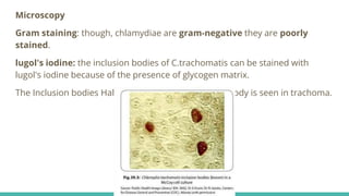 Microscopy
Gram staining: though, chlamydiae are gram-negative they are poorly
stained.
lugol's iodine: the inclusion bodies of C.trachomatis can be stained with
lugol's iodine because of the presence of glycogen matrix.
The Inclusion bodies Halberstaedter-Prowazek (H-P) body is seen in trachoma.
 