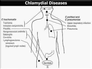 Chlamydia In Humans Chlamydiae | PPT