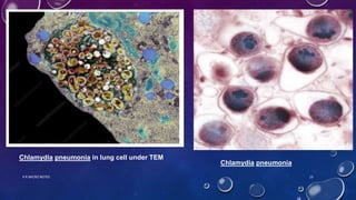 Chlamydia pneumonia in lung cell under TEM
Chlamydia pneumonia
K R MICRO NOTES 15
 