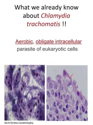 Chlamydia Trachomatis Microscopy