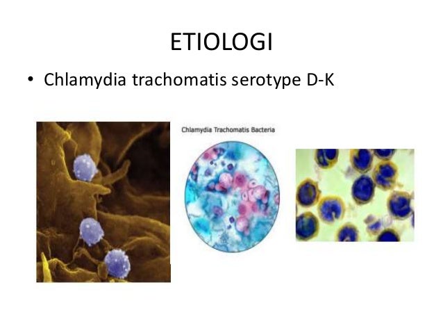 Anti chlamydia trachomatis