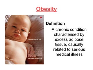 Obesity
Definition
A chronic condition
characterised by
excess adipose
tissue, causally
related to serious
medical illness
 