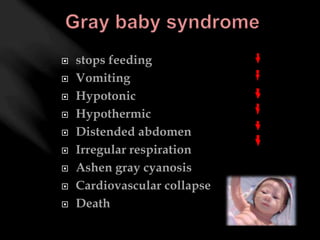  Meningococcal meningitis 