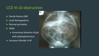 CCD Vs GI obstruction
 Family history (AR)
 Local demographics
 Normal peristalsis
 ANSS:
 Generalized dilatation of gut
with polyhydramnious
 Increase chloride in AF
 