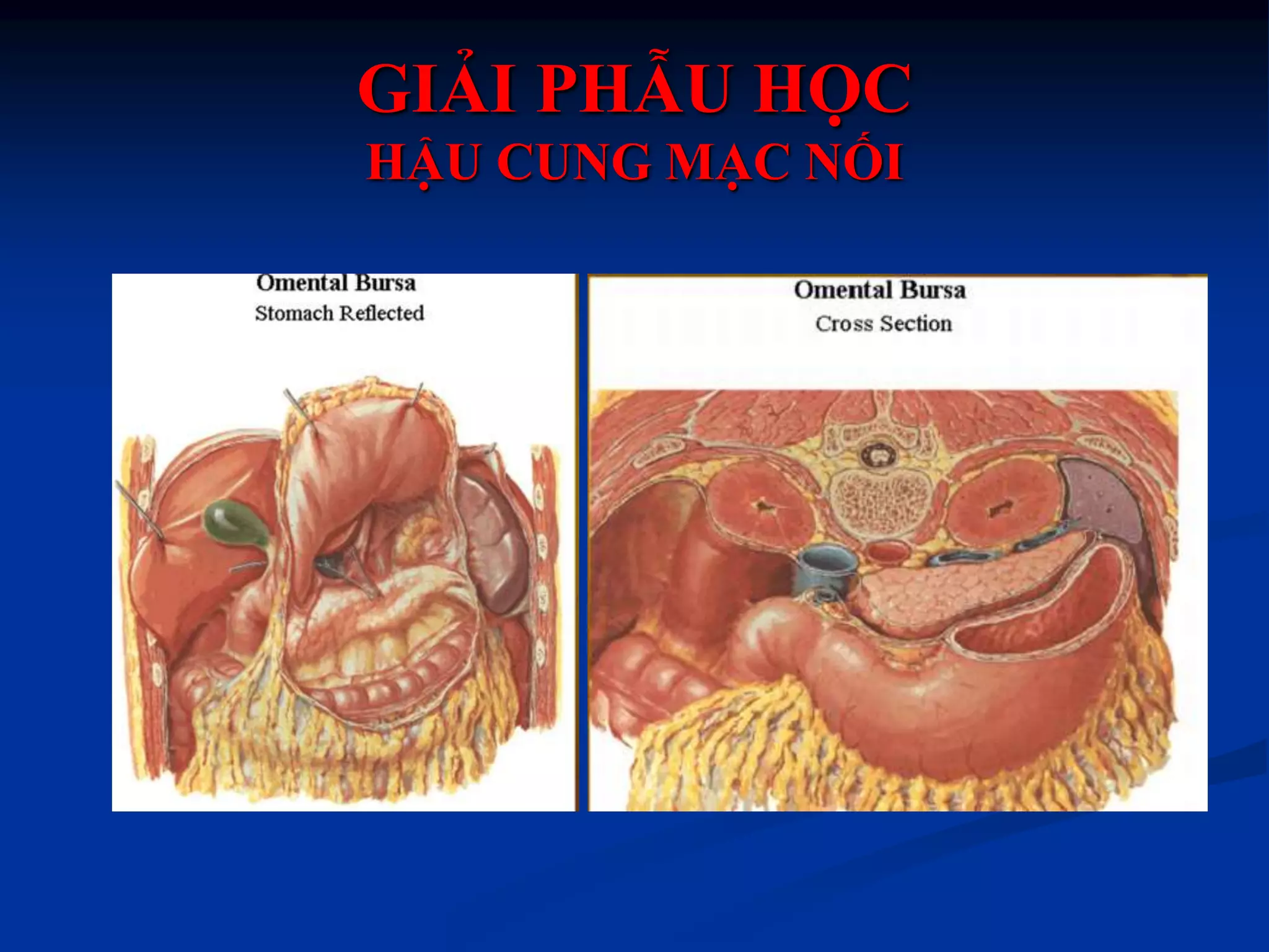 Chẩn đoán hình ảnh thủng tạng rỗng ok | PPTX