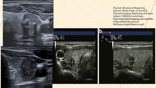 Comprehensive Ultrasound Diagnosis and Risk Assessment of Thyroid ...
