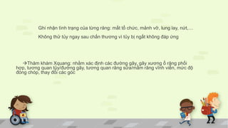 Ghi nhận tình trạng của từng răng: mất tổ chức, mảnh vỡ, lung lay, nứt,…
Không thử tủy ngay sau chấn thương vì tủy bị ngất không đáp ứng
Thăm khám Xquang: nhằm xác định các đường gãy, gãy xương ổ răng phối
hợp, tương quan tủy/đường gãy, tương quan răng sữa/mầm răng vĩnh viễn, mức độ
đóng chóp, thay đổi các góc
 