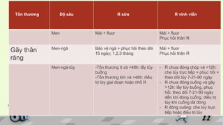 Tổn thương Độ sâu R sữa R vĩnh viễn
Men Mài + fluor Mài + fluor
Phục hồi thân R
Gãy thân
răng
Men-ngà Bảo vệ ngà + phục hồi theo dõi
15 ngày; 1,2,3 tháng
Mài + fluor
Phục hồi thân R
Men-ngà-tủy -Tổn thương ít và <48h: lấy tủy
buồng
-Tổn thương lớn và >48h: điều
trị tủy giai đoạn hoặc nhổ R
- R chưa đóng chóp và <12h:
che tủy trực tiếp + phục hồi +
theo dõi tủy 7-21-90 ngày
- R chưa đóng cuống và gãy
>12h: lấy tủy buồng, phục
hồi, theo dõi 7-21-90 ngày
đến khi đóng cuống, điều trị
tủy khi cuống đã đóng
- R đóng cuống: che tủy trực
tiếp hoặc điều trị tủy
 