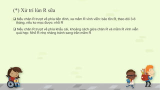 (*) Xử trí lún R sữa
 Nếu chân R trượt về phía tiền đình, xa mầm R vĩnh viễn: bảo tồn R, theo dõi 3-6
tháng, nếu ko mọc được: nhổ R
 Nếu chân R trượt về phía khẩu cái, khoảng cách giữa chân R và mầm R vĩnh viễn
quá hẹp: Nhổ R nhẹ nhàng tránh sang trấn mầm R
 