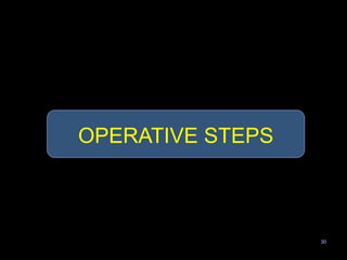 30
OPERATIVE STEPS
 