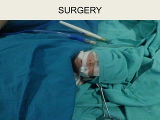 34
SURGERY
 