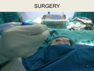 35
SURGERY
 