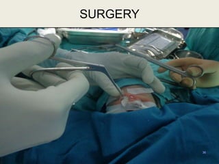 36
SURGERY
 