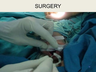 37
SURGERY
 