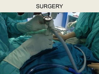 38
SURGERY
 