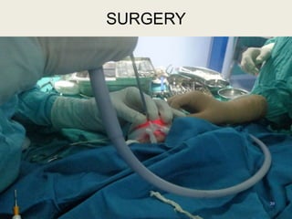 39
SURGERY
 