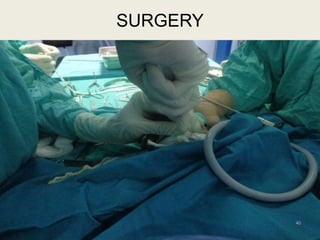 40
SURGERY
 