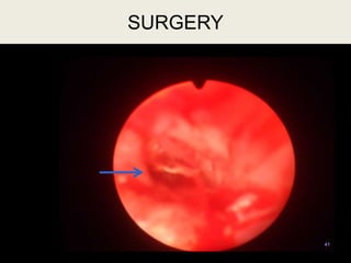 41
SURGERY
 