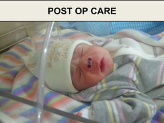 48
POST OP CARE
 