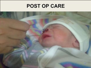 49
POST OP CARE
 