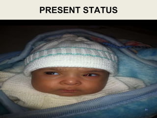 51
PRESENT STATUS
 