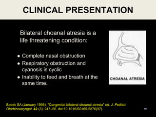 CLINICAL PRESENTATION
60
Bilateral choanal atresia is a
life threatening condition:
 Complete nasal obstruction
 Respiratory obstruction and
cyanosis is cyclic
 Inability to feed and breath at the
same time.
Sadek SA (January 1998). "Congenital bilateral choanal atresia" Int. J. Pediatr.
Otorhinolaryngol. 42 (3): 247–56. doi:10.1016/S0165-5876(97)
 