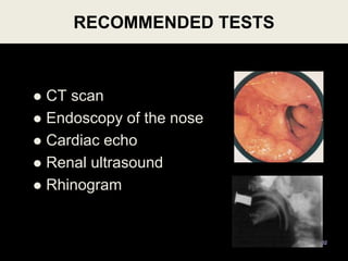 RECOMMENDED TESTS
62
 CT scan
 Endoscopy of the nose
 Cardiac echo
 Renal ultrasound
 Rhinogram
 