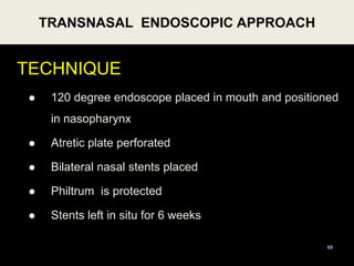 TECHNIQUE
 120 degree endoscope placed in mouth and positioned
in nasopharynx
 Atretic plate perforated
 Bilateral nasal stents placed
 Philtrum is protected
 Stents left in situ for 6 weeks
TRANSNASAL ENDOSCOPIC APPROACH
68
 