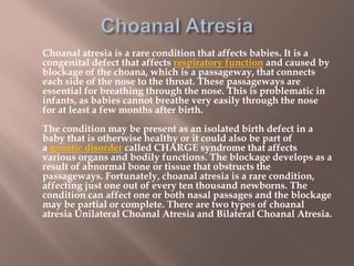 Choanal atresia | PPTX
