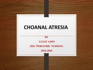 CHOANAL ATRESIA
BY
ULFAT AMIN
MSC PEDIATRIC NURSING
2016-2018
 