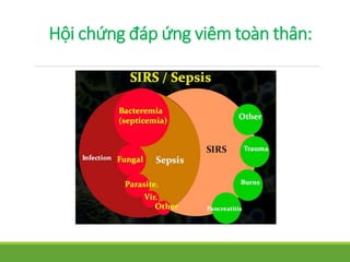 Hội chứng đáp ứng viêm toàn thân:
 