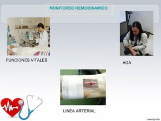 MONITOREO HEMODINAMICO
FUNCIONES VITALES
LINEA ARTERIAL
AGA
 