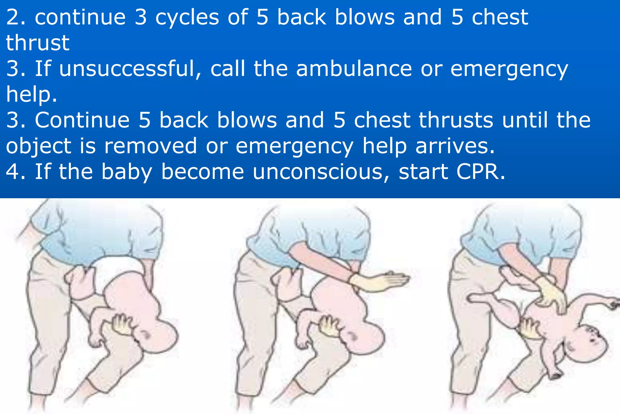 Choking | PPT