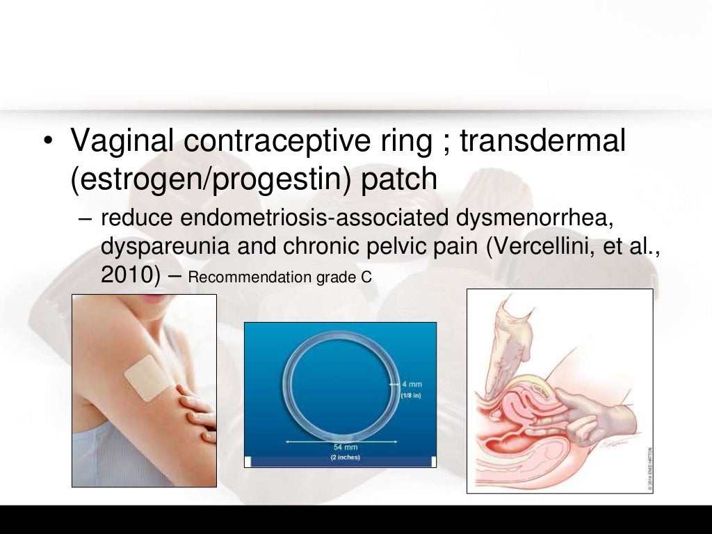 Chocolate cyst a trick or a treat