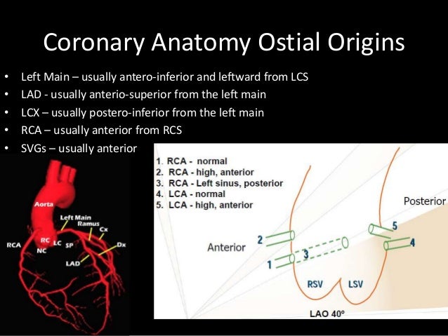 Choice of guiding catheters in PCI heart diagram rca 