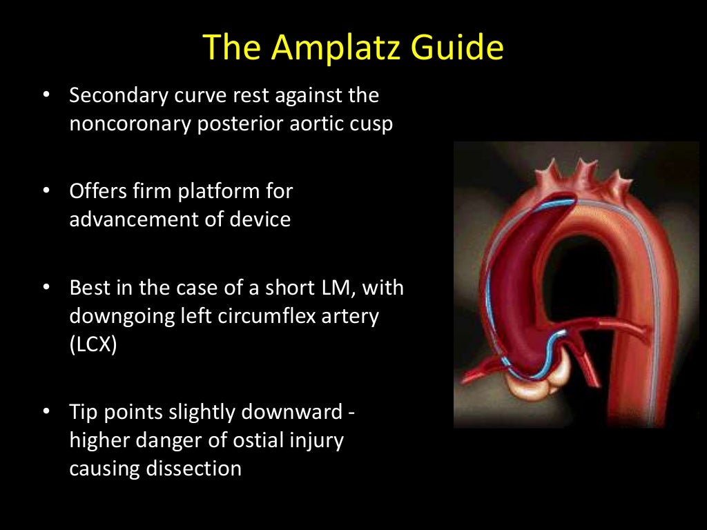 Choice of guiding catheters in PCI